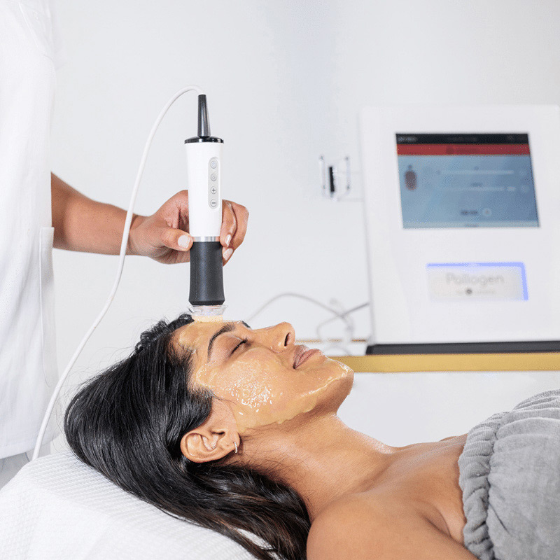 Geneo-Exfoliation-Treatment